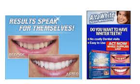 Alta White Teeth - opinioni - prezzo