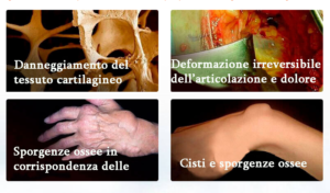 Italia - opinioni - forum - funziona - recensioni - chi l’ha provato - Arthromagic